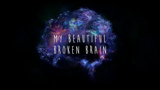 Watch The Trailer For My Beautiful Broken Brain, Executive Produced By David Lynch