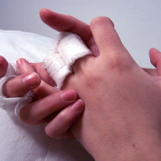 The FDA Has Approved a New Treatment for Moderate-to-Severe Eczema
