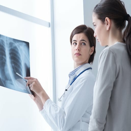 When Women Persist, They Can Beat Lung Cancer