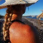 Study Suggests Alcohol Causes Skin to Sunburn Faster