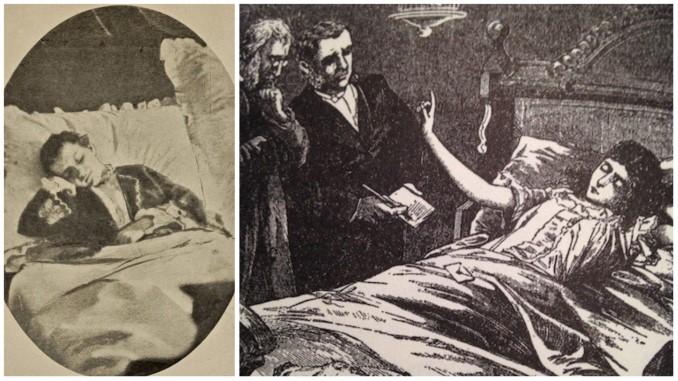 The “Fasting Girl”: A Victorian Phenomenon That Made Starvation Trendy